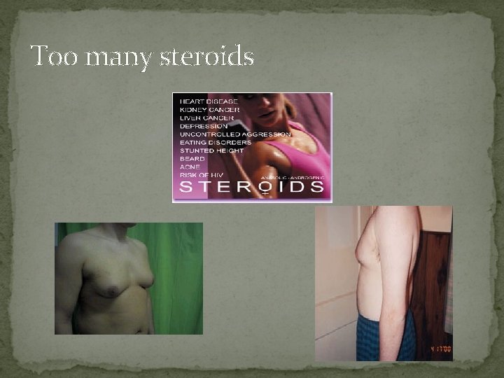 Too many steroids 
