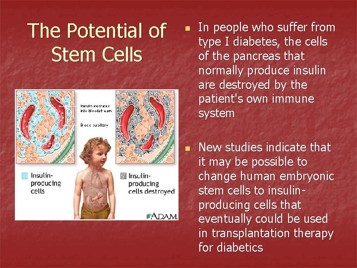 The Potential of Stem Cells n n In people who suffer from type I