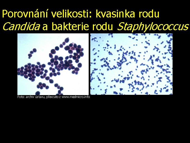 Porovnání velikosti: kvasinka rodu Candida a bakterie rodu Staphylococcus Foto: archiv ústavu, převzato z