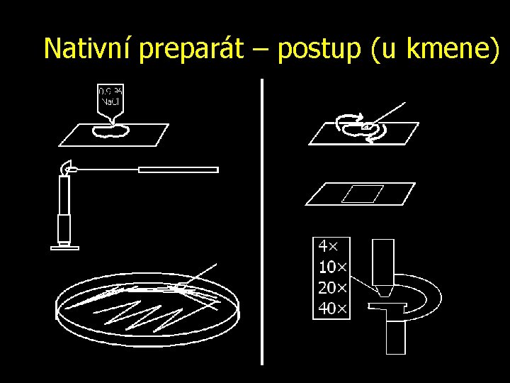 Nativní preparát – postup (u kmene) 