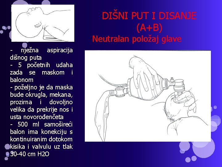 DIŠNI PUT I DISANJE (A+B) Neutralan položaj glave - nježna aspiracija dišnog puta -