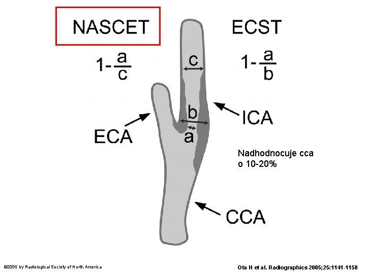 Nadhodnocuje cca o 10 -20% © 2005 by Radiological Society of North America Ota