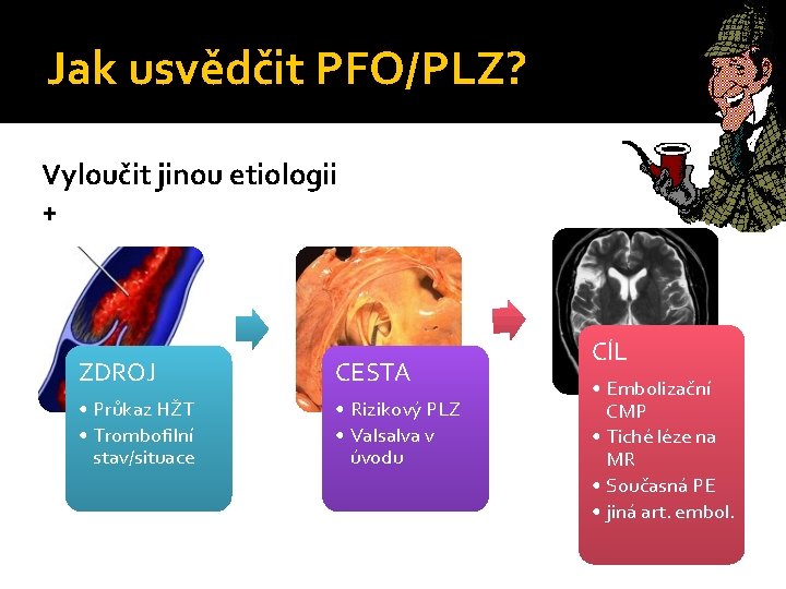 Jak usvědčit PFO/PLZ? Vyloučit jinou etiologii + ZDROJ CESTA • Průkaz HŽT • Trombofilní