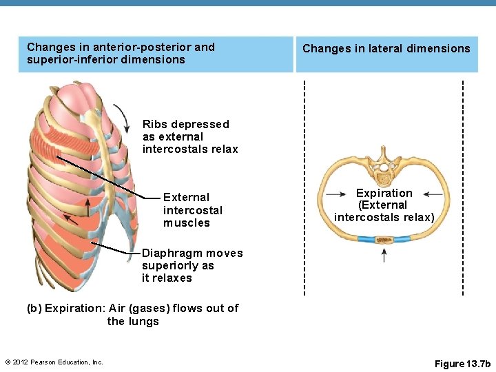 Changes in anterior-posterior and superior-inferior dimensions Changes in lateral dimensions Ribs depressed as external