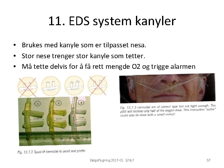 11. EDS system kanyler • Brukes med kanyle som er tilpasset nesa. • Stor
