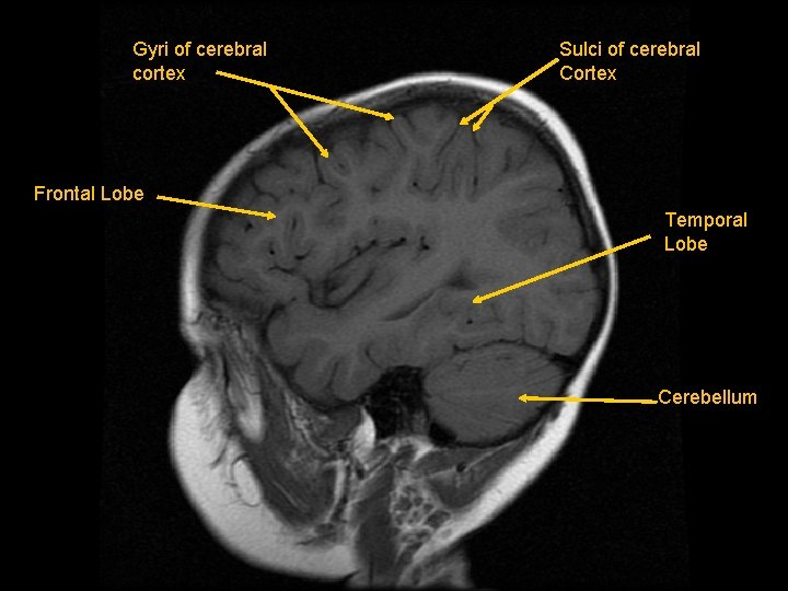 Gyri of cerebral cortex Sulci of cerebral Cortex Frontal Lobe Temporal Lobe Cerebellum 