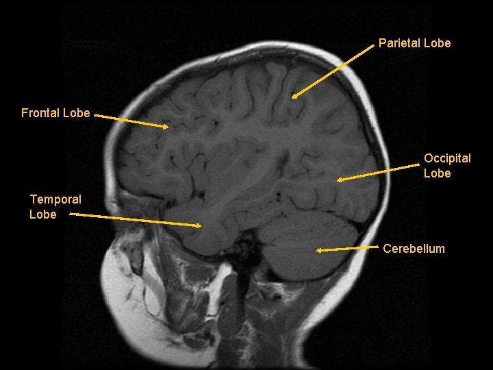 Parietal Lobe Frontal Lobe Occipital Lobe Temporal Lobe Cerebellum 
