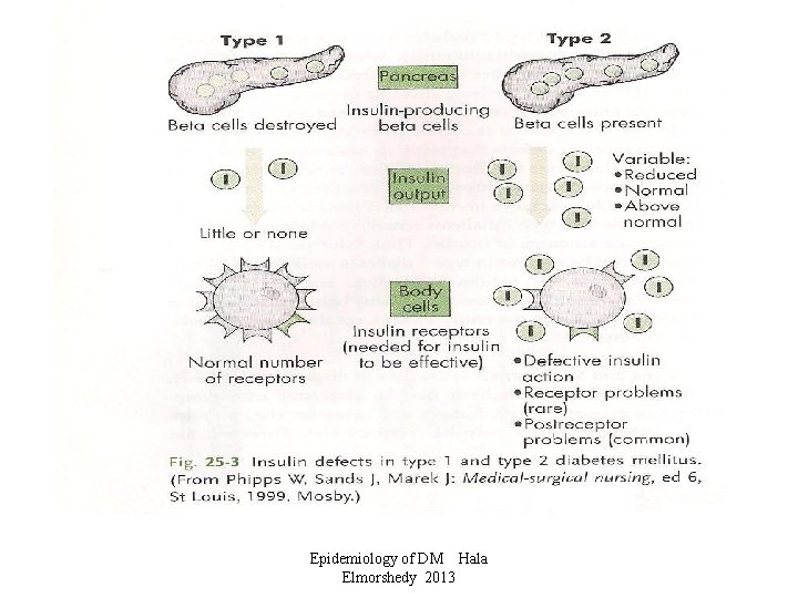 Epidemiology of DM Hala Elmorshedy 2013 