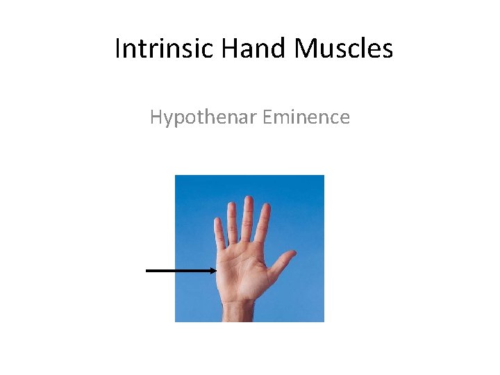 Intrinsic Hand Muscles Hypothenar Eminence 
