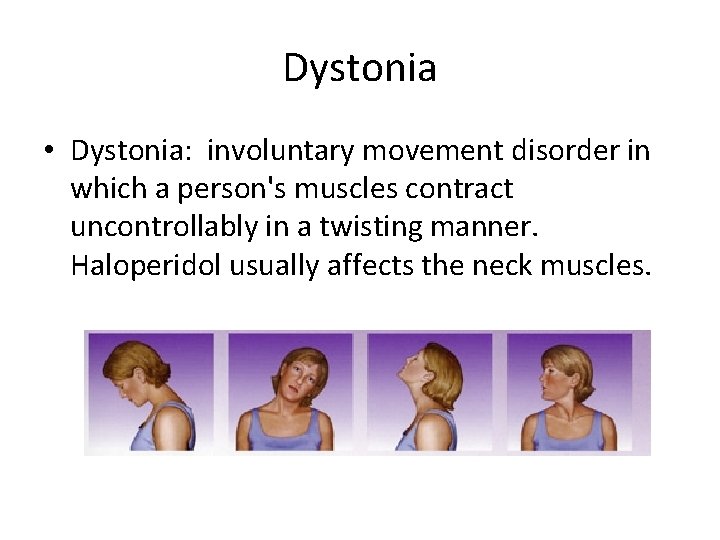 Dystonia • Dystonia: involuntary movement disorder in which a person's muscles contract uncontrollably in