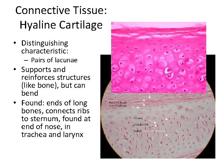 Connective Tissue: Hyaline Cartilage • Distinguishing characteristic: – Pairs of lacunae • Supports and