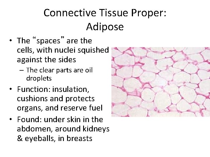 Connective Tissue Proper: Adipose • The “spaces” are the cells, with nuclei squished against