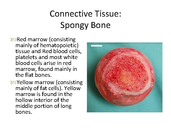 Connective Tissue: Spongy Bone Red marrow (consisting mainly of hematopoietic) tissue and Red blood