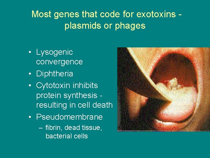 Most genes that code for exotoxins plasmids or phages • Lysogenic convergence • Diphtheria