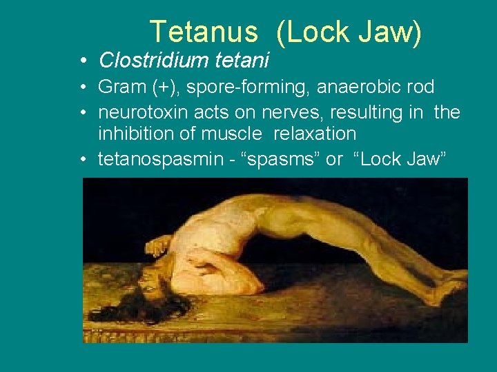 Tetanus (Lock Jaw) • Clostridium tetani • Gram (+), spore-forming, anaerobic rod • neurotoxin