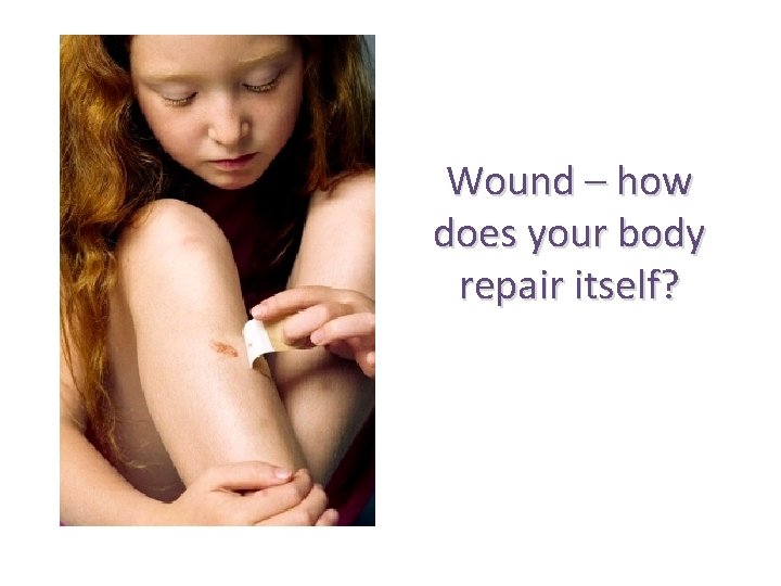 Wound – how does your body repair itself? 