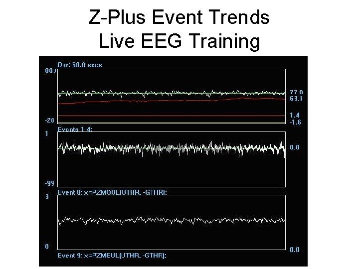 Z-Plus Event Trends Live EEG Training 