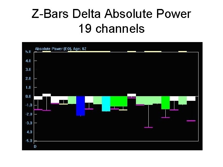 Z-Bars Delta Absolute Power 19 channels 