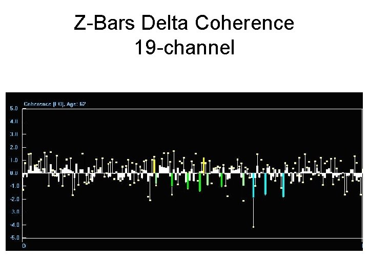 Z-Bars Delta Coherence 19 -channel 