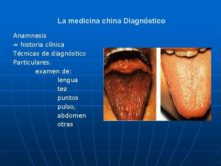 La medicina china Diagnóstico Anamnesis = historia clínica Técnicas de diagnóstico Particulares. examen de: