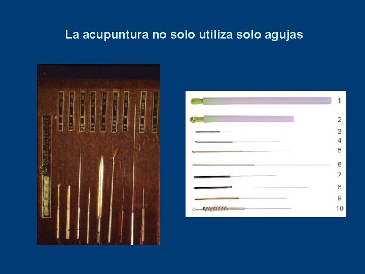 La acupuntura no solo utiliza solo agujas 
