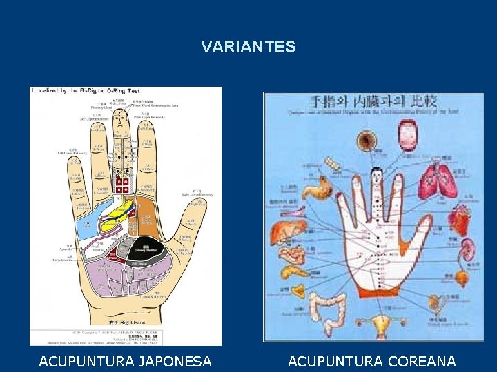 VARIANTES ACUPUNTURA JAPONESA ACUPUNTURA COREANA 