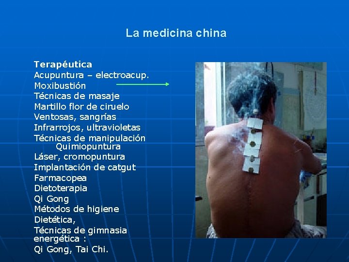 La medicina china Terapéutica Acupuntura – electroacup. Moxibustión Técnicas de masaje Martillo flor de