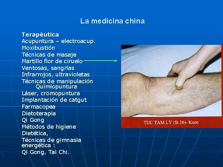 La medicina china Terapéutica Acupuntura – electroacup. Moxibustión Técnicas de masaje Martillo flor de