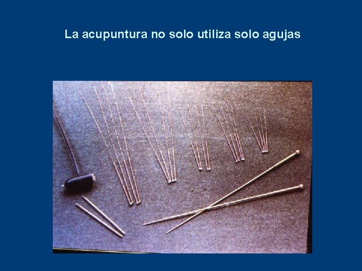 La acupuntura no solo utiliza solo agujas 