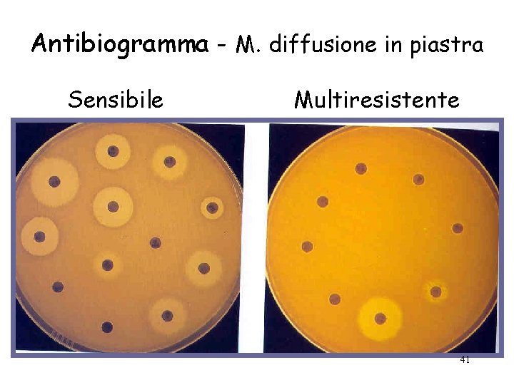 Antibiogramma - M. diffusione in piastra Sensibile Multiresistente 41 
