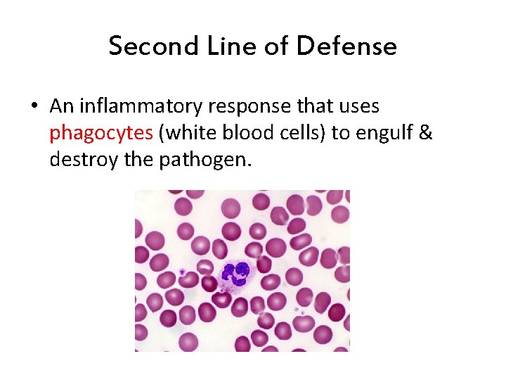 Second Line of Defense • An inflammatory response that uses phagocytes (white blood cells) Second Line of Defense • An inflammatory response that uses phagocytes (white blood cells)