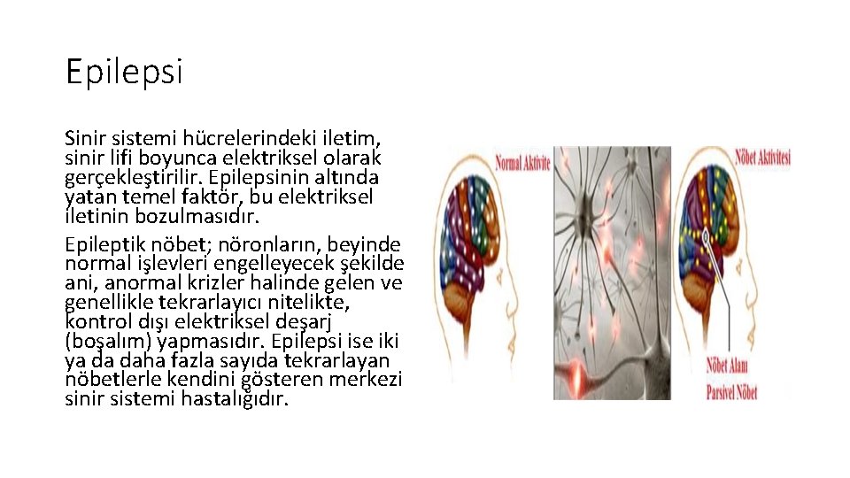 Epilepsi Sinir sistemi hücrelerindeki iletim, sinir lifi boyunca elektriksel olarak gerçekleştirilir. Epilepsinin altında yatan