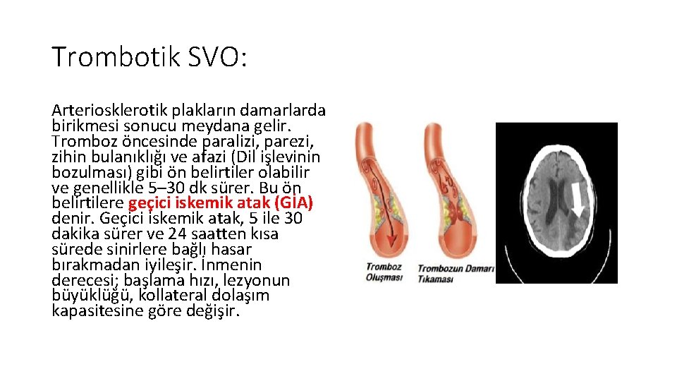 Trombotik SVO: Arteriosklerotik plakların damarlarda birikmesi sonucu meydana gelir. Tromboz öncesinde paralizi, parezi, zihin
