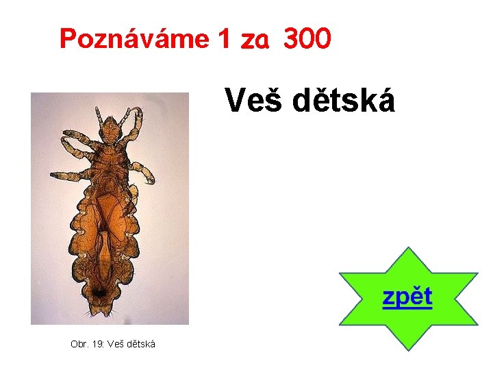 Poznáváme 1 za 300 Veš dětská Obr. 19: Veš dětská 