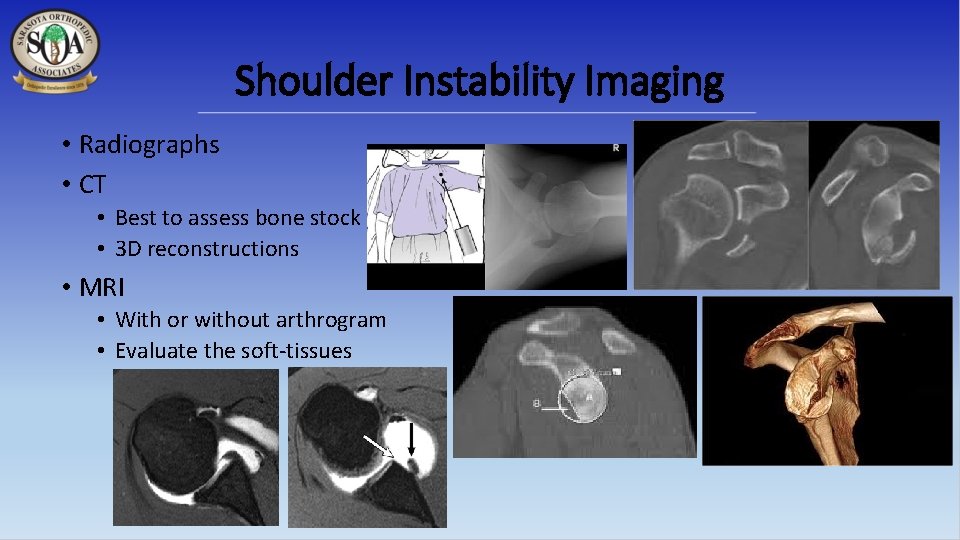 Shoulder Instability Imaging • Radiographs • CT • Best to assess bone stock •