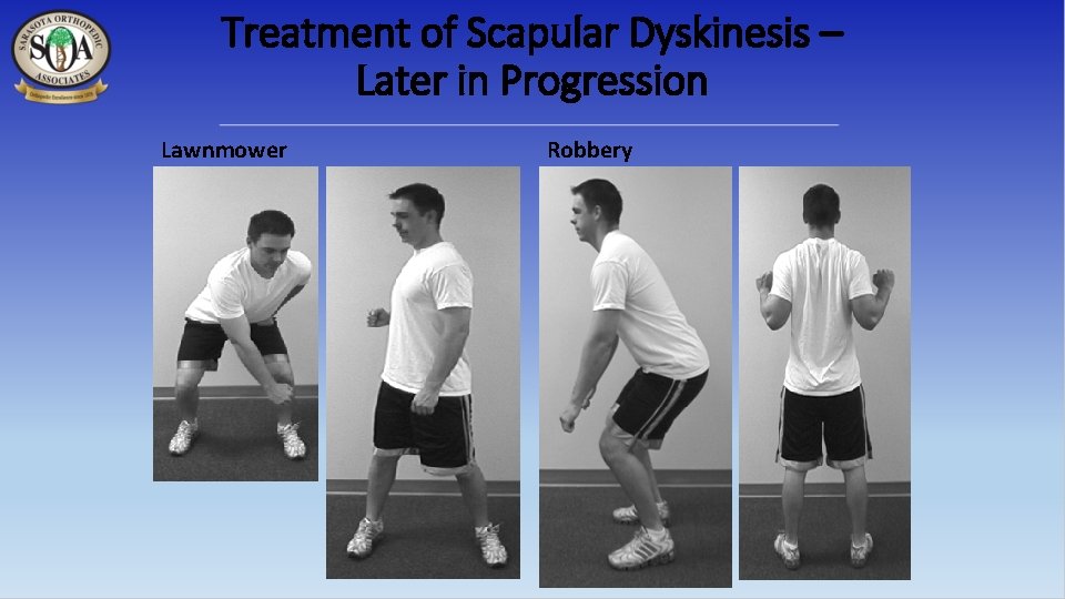 Treatment of Scapular Dyskinesis – Later in Progression Lawnmower Robbery 
