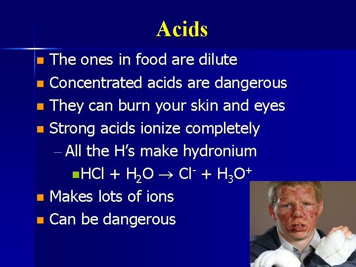 Acids The ones in food are dilute n Concentrated acids are dangerous n They