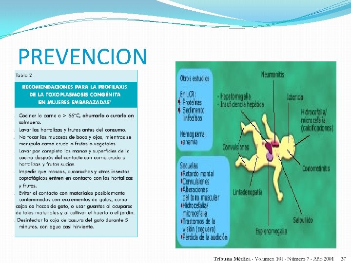 PREVENCION 