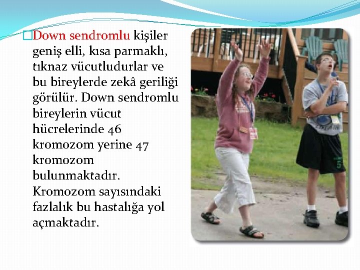 �Down sendromlu kişiler geniş elli, kısa parmaklı, tıknaz vücutludurlar ve bu bireylerde zekâ geriliği