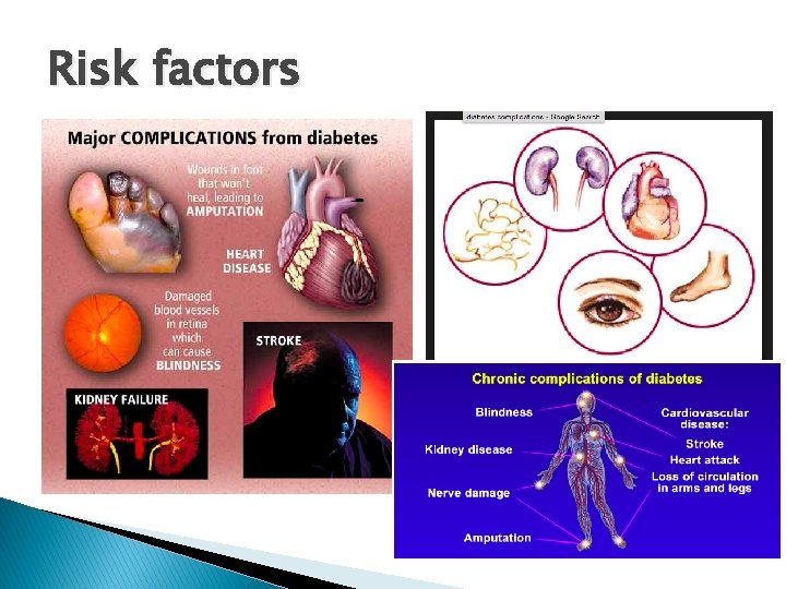 Risk factors 