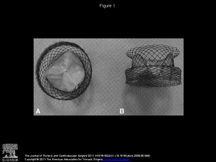 Figure 1 The Journal of Thoracic and Cardiovascular Surgery 2011 141518 -522 DOI: (10.