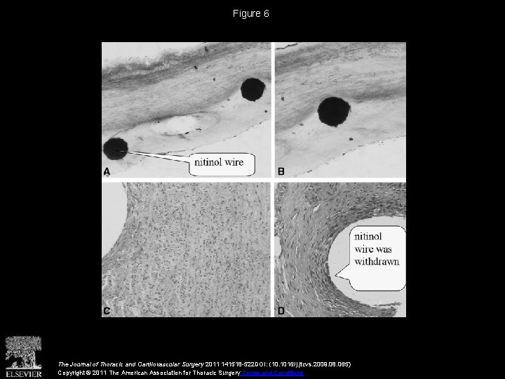 Figure 6 The Journal of Thoracic and Cardiovascular Surgery 2011 141518 -522 DOI: (10.