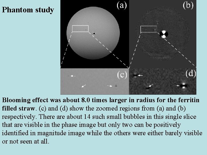 Phantom study Blooming effect was about 8. 0 times larger in radius for the