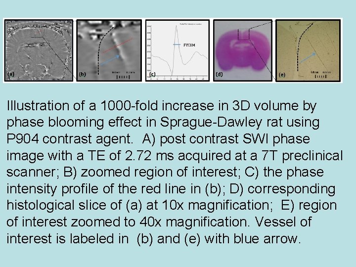 Illustration of a 1000 -fold increase in 3 D volume by phase blooming effect