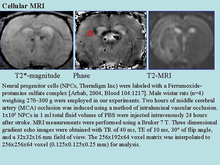 Cellular MRI T 2*-magnitude Phase T 2 -MRI Neural progenitor cells (NPCs, Theradigm Inc)