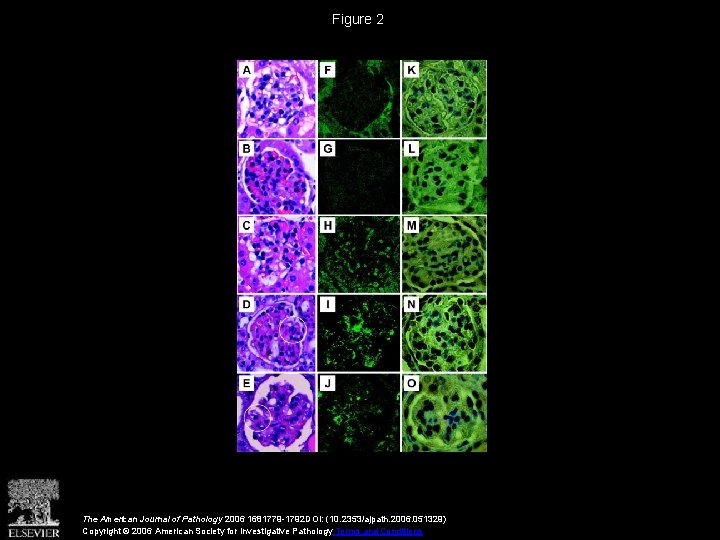 Figure 2 The American Journal of Pathology 2006 1681779 -1792 DOI: (10. 2353/ajpath. 2006.