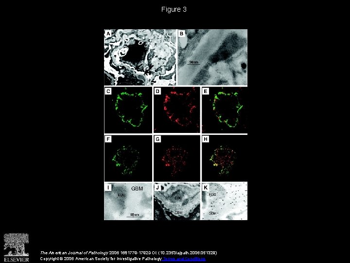 Figure 3 The American Journal of Pathology 2006 1681779 -1792 DOI: (10. 2353/ajpath. 2006.