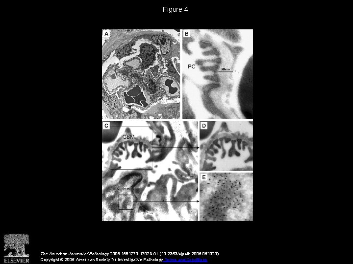 Figure 4 The American Journal of Pathology 2006 1681779 -1792 DOI: (10. 2353/ajpath. 2006.