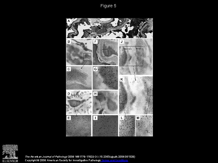 Figure 5 The American Journal of Pathology 2006 1681779 -1792 DOI: (10. 2353/ajpath. 2006.