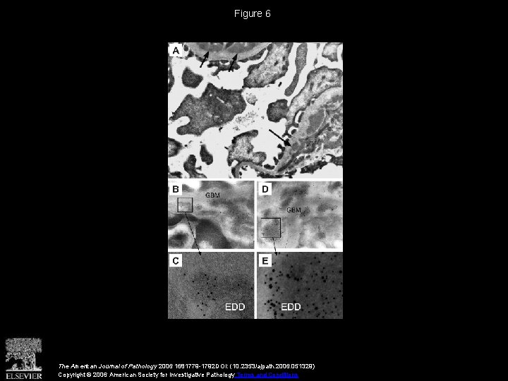 Figure 6 The American Journal of Pathology 2006 1681779 -1792 DOI: (10. 2353/ajpath. 2006.